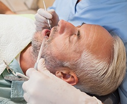 Man with greying hair during dental exam
