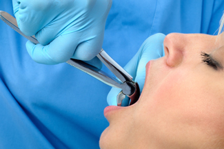 Woman having tooth extracted